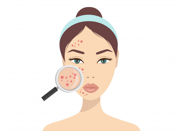 Op zoek naar een acne behandeling in regio Dordrecht? Boek nu een consult bij onze gespecialiseerde huidtherapeut.