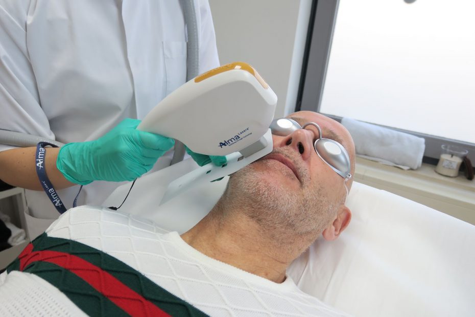 Huidtherapeut voert laserbehandeling voor huidverbetering bij pigmentvlekken in het gezicht uit.
