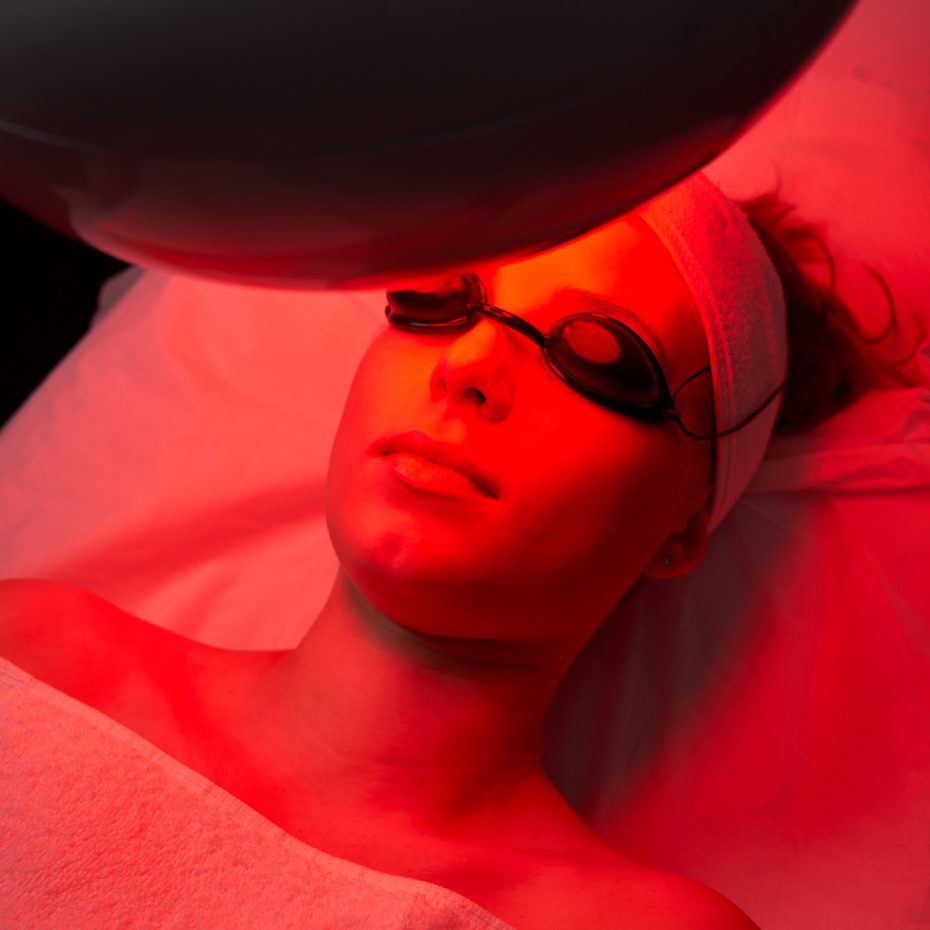 Huidtherapie met rood LED licht voor huidverbetering en herstel van jouw huid na een peeling of laserbehandeling